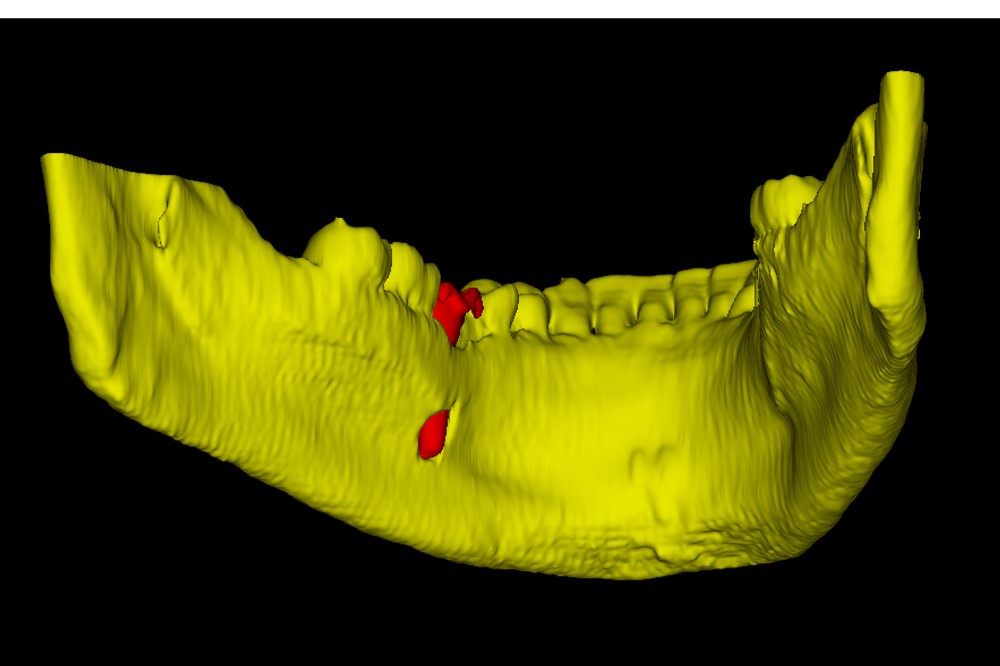 Использование 3D-печати в стоматологии