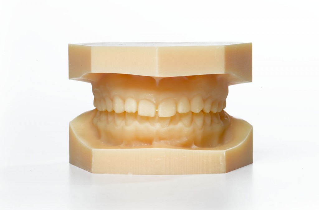 Использование 3D-печати в стоматологии